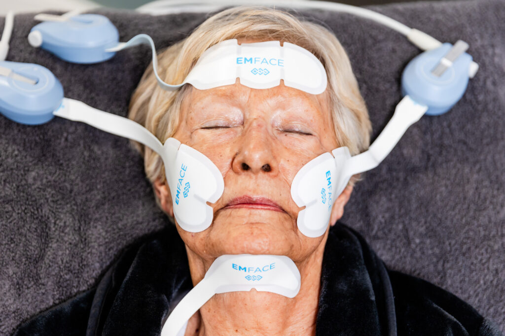 close-up of a mature female patient receiving an Emface treatment for facial contouring in Evansville, IN