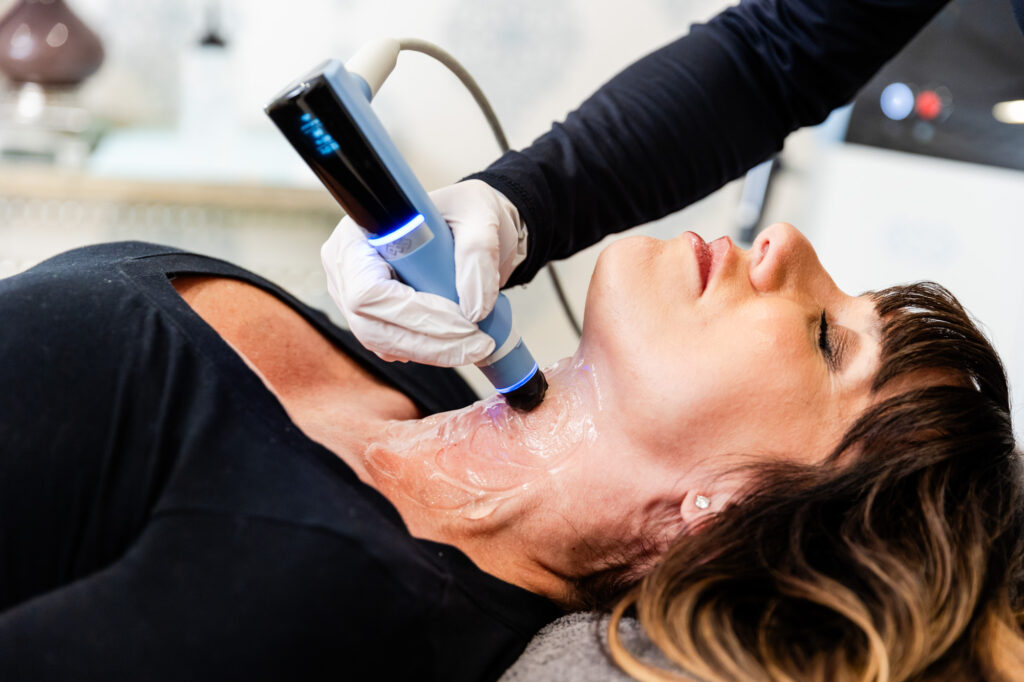 close-up of a female patient receiving an Exion neck treatment for skin rejuvenation in Franklin, TN